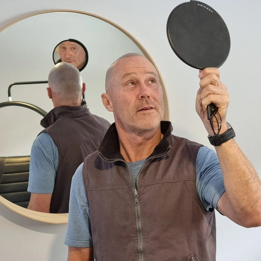 Scalp Micropigmentation Yokine Perth Wa