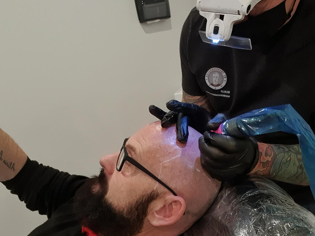 Should You Train In Scalp Micropigmentation?