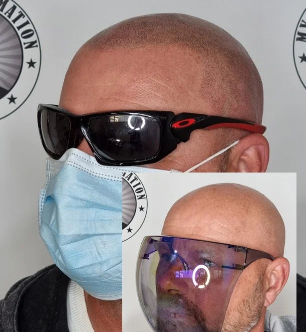 Scalp Micropigmentation Tapping Perth WA