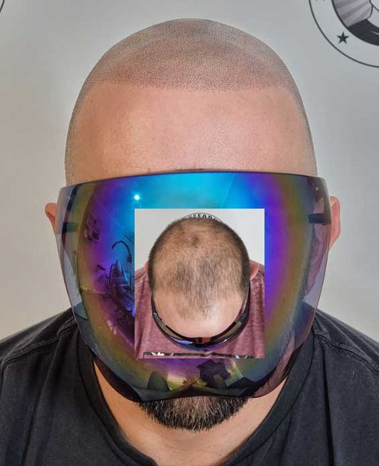 Scalp Micropigmentation Mount Pleasant Perth Wa