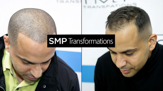 7 Incredible Micro Scalp Pigmentation Before and After Transformations of 2026