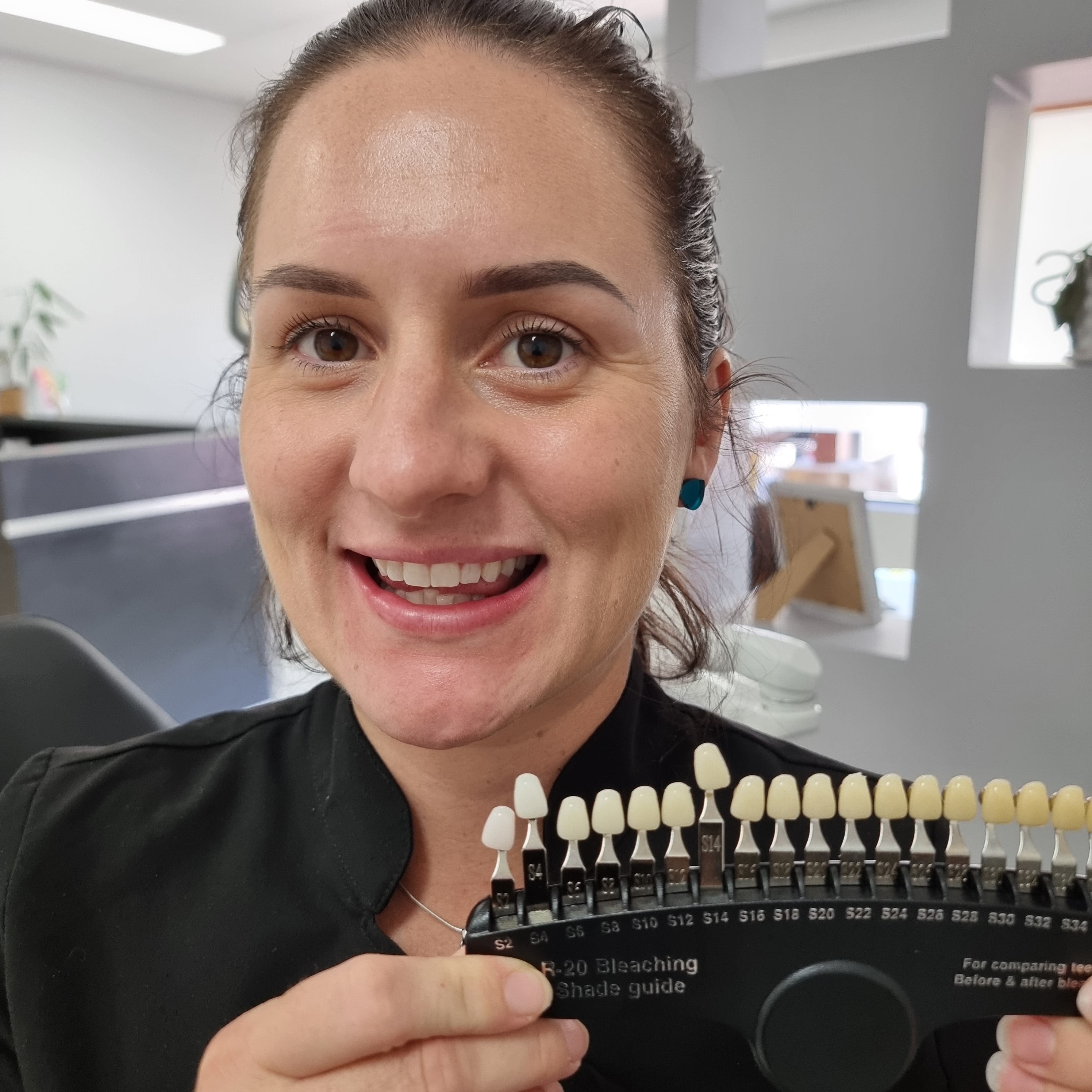 My Transformation, Teeth Witening Perth, Cosmetic Whitening, Instantley A Whiter Smile, Affordable Cosmetic Teeth Whitening,