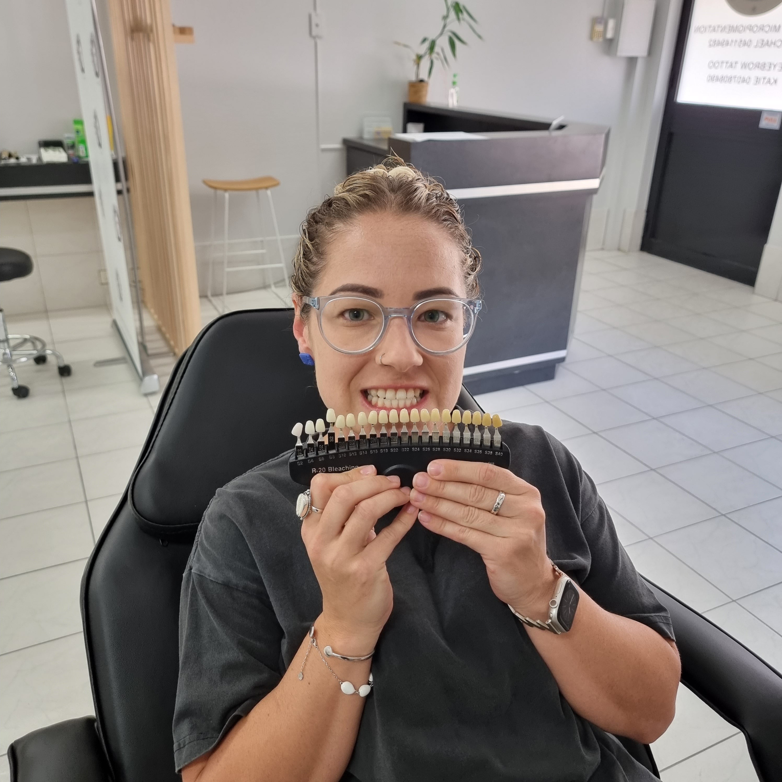 My Transformation, Teeth Witening Perth, Cosmetic Whitening, Instantley A Whiter Smile, Affordable Cosmetic Teeth Whitening,