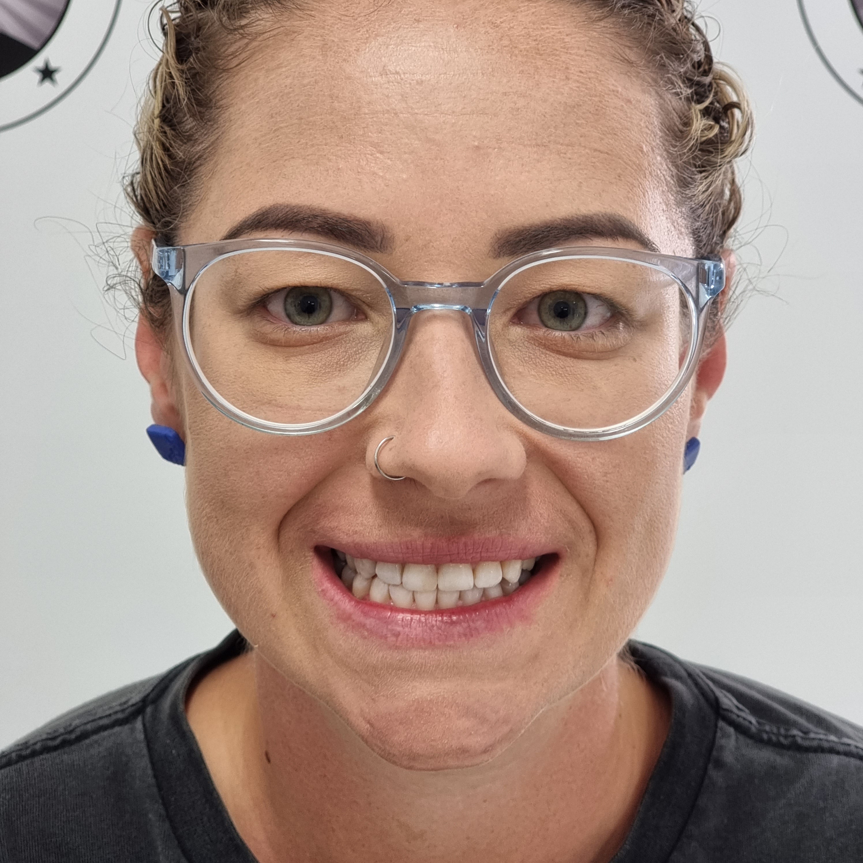 My Transformation, Teeth Witening Perth, Cosmetic Whitening, Instantley A Whiter Smile, Affordable Cosmetic Teeth Whitening,