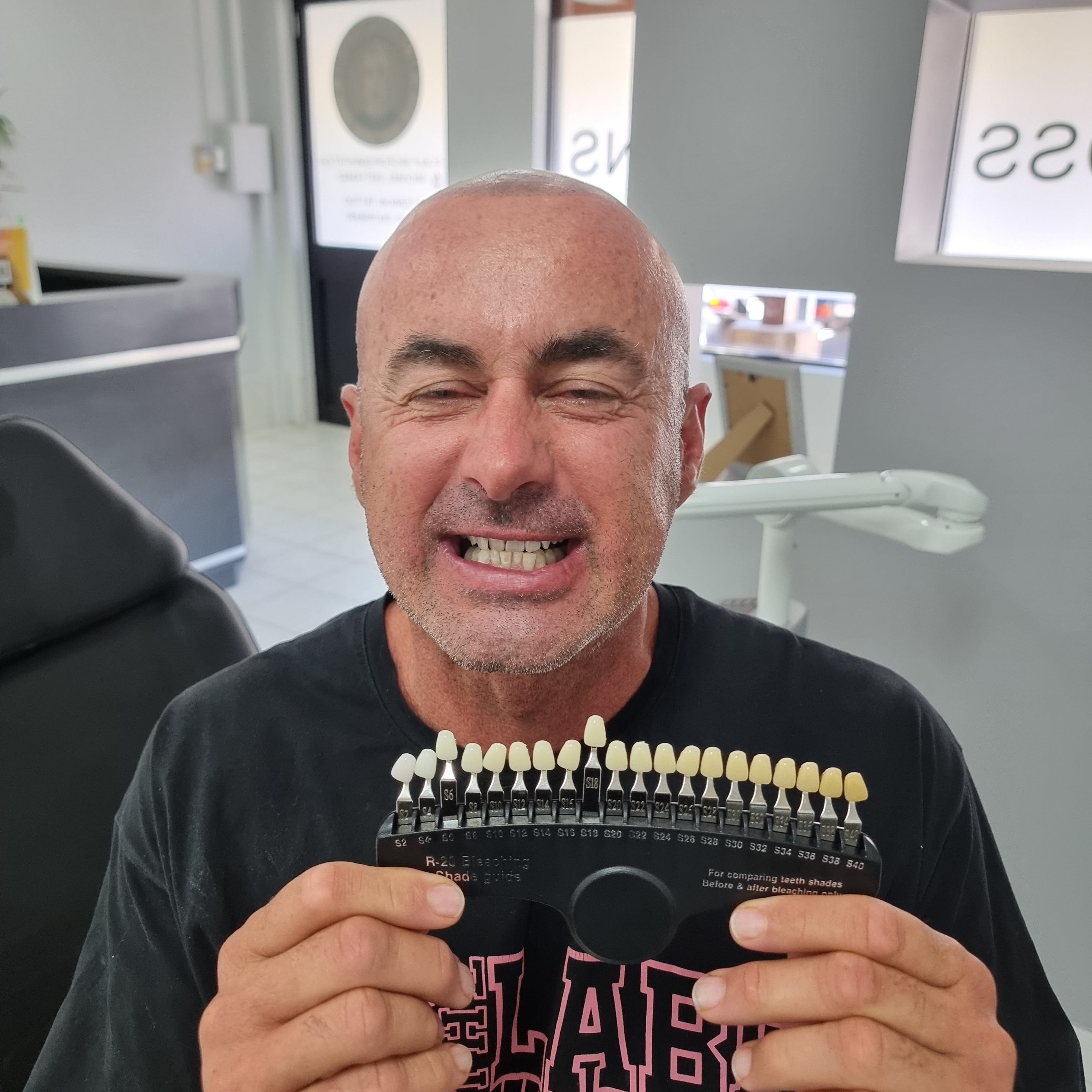 My Transformation, Teeth Witening Perth, Cosmetic Whitening, Instantley A Whiter Smile, Affordable Cosmetic Teeth Whitening,