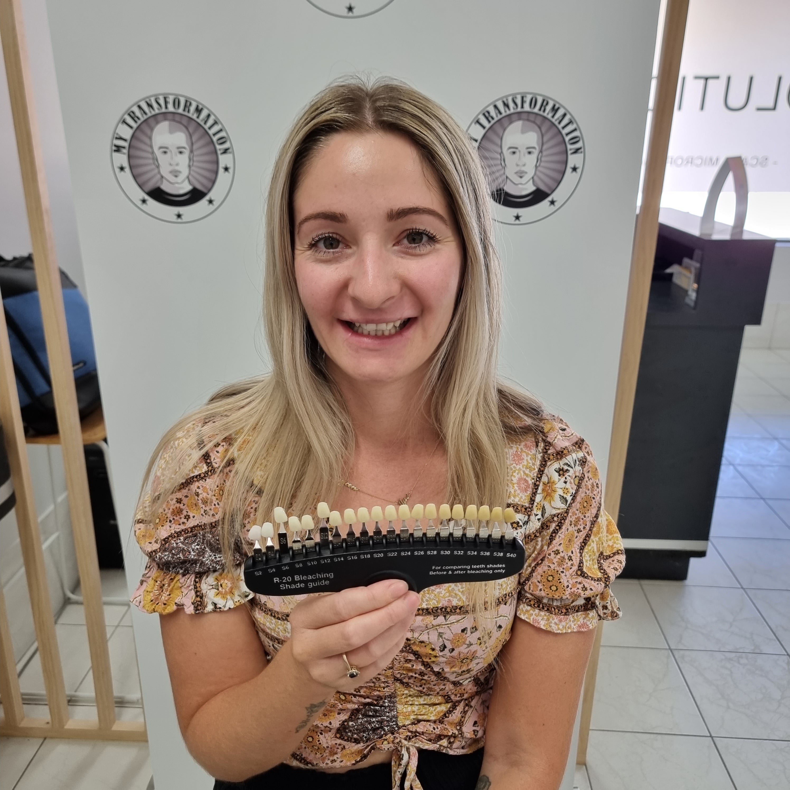 My Transformation, Teeth Witening Perth, Cosmetic Whitening, Instantley A Whiter Smile, Affordable Cosmetic Teeth Whitening,