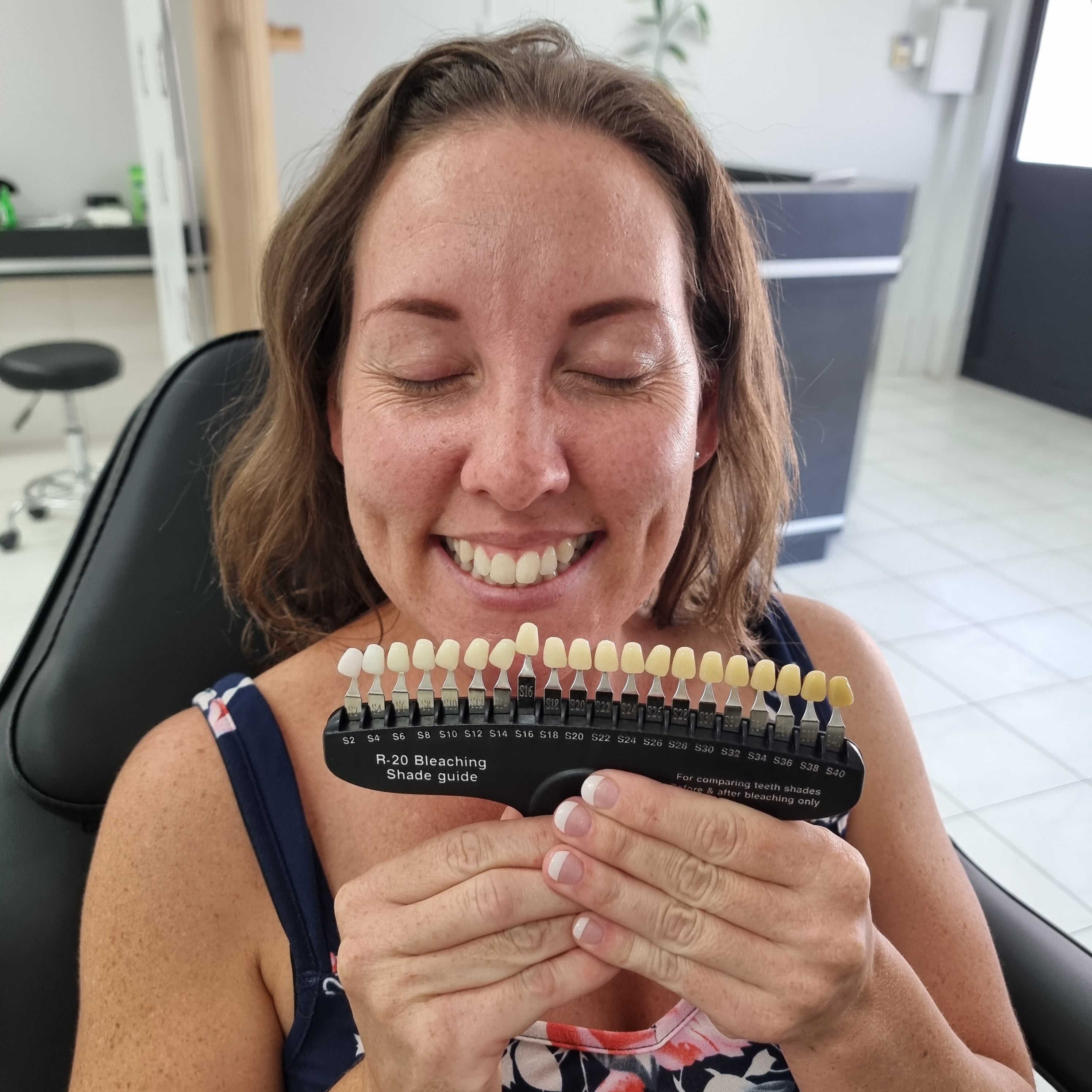 My Transformation, Teeth Witening Perth, Cosmetic Whitening, Instantley A Whiter Smile, Affordable Cosmetic Teeth Whitening,