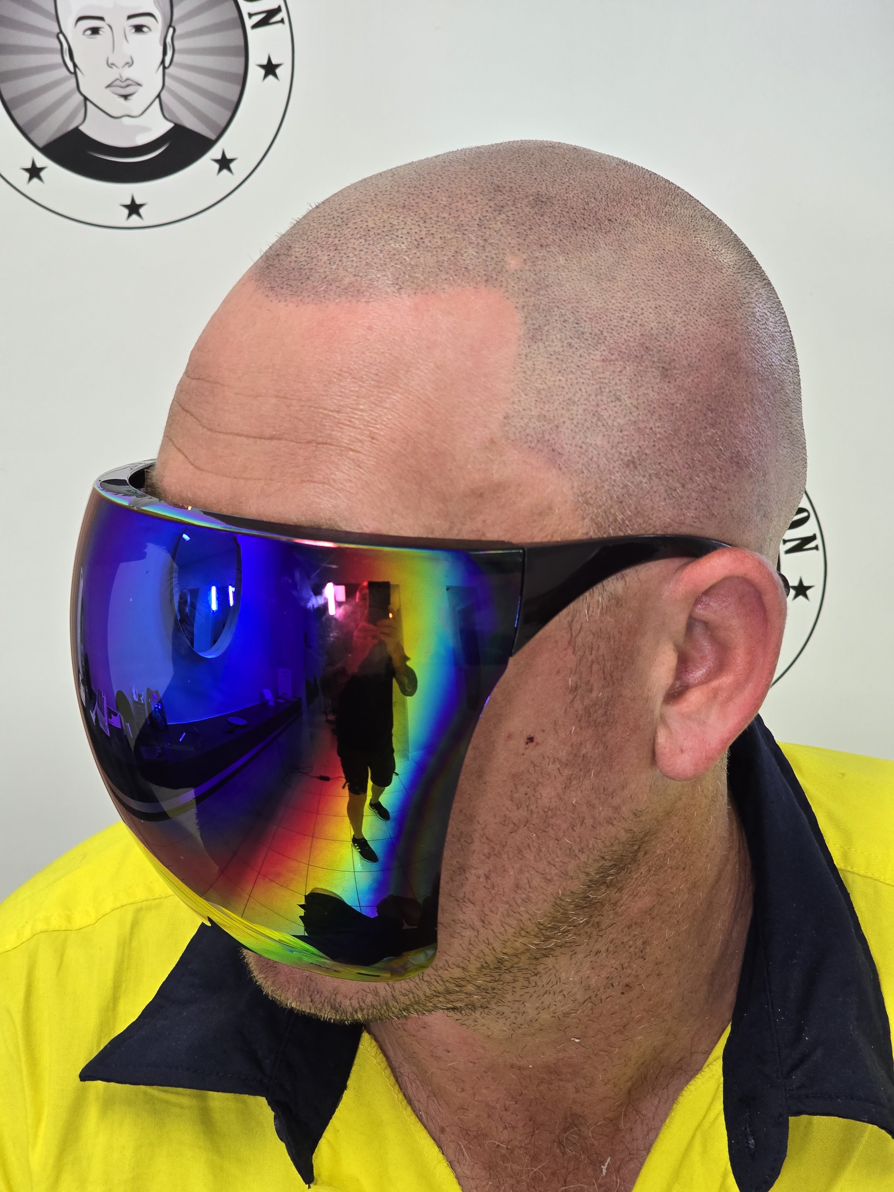 My Transformation, Scalp Micropigmentation Perth, Hair Tattoo Perth, SMP Perth, SMP WA, Perth Australia, Men's hair Tattoo