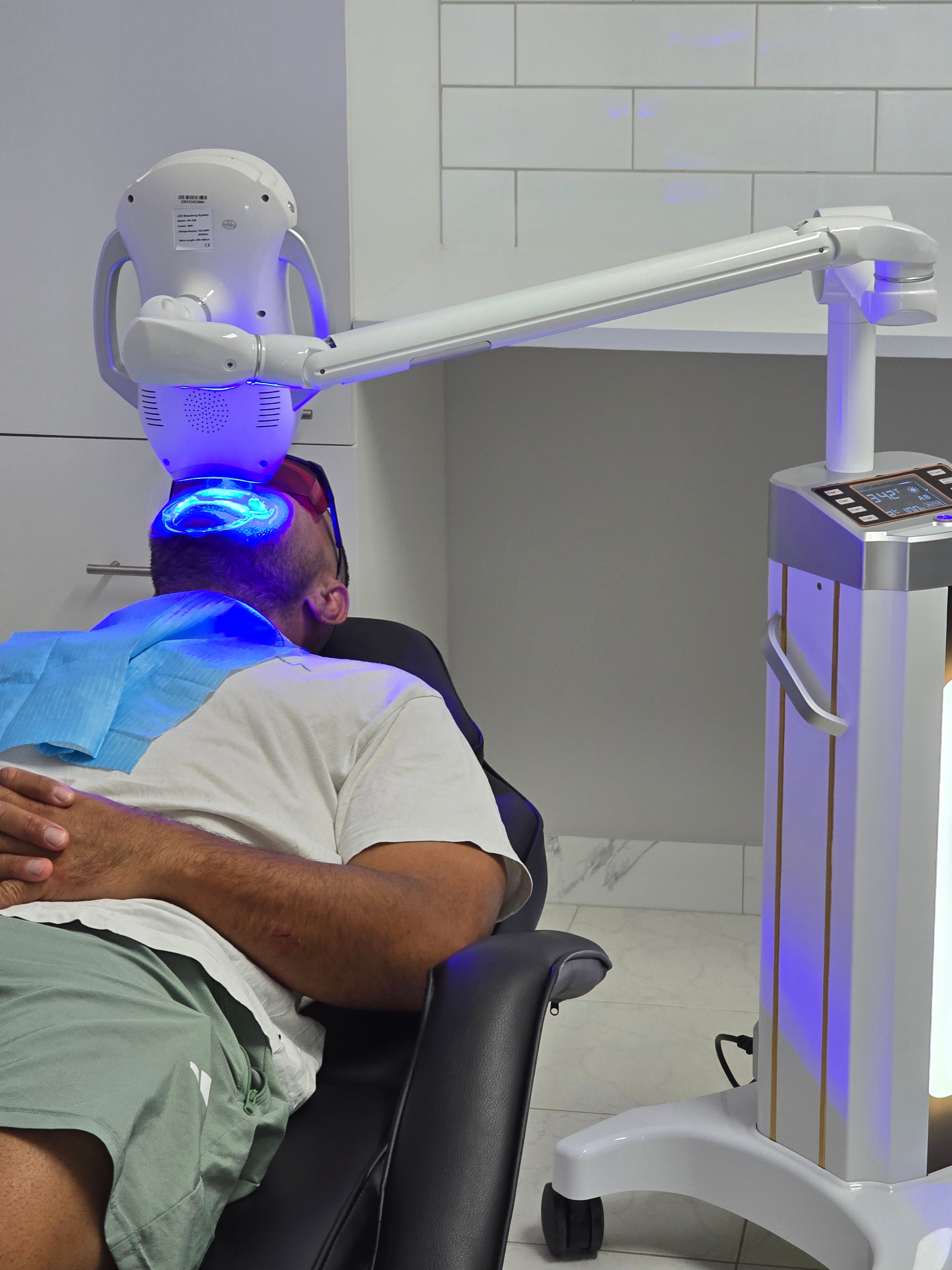 My Transformation, Teeth Witening Perth, Cosmetic Whitening, Instantley A Whiter Smile, Affordable Cosmetic Teeth Whitening,