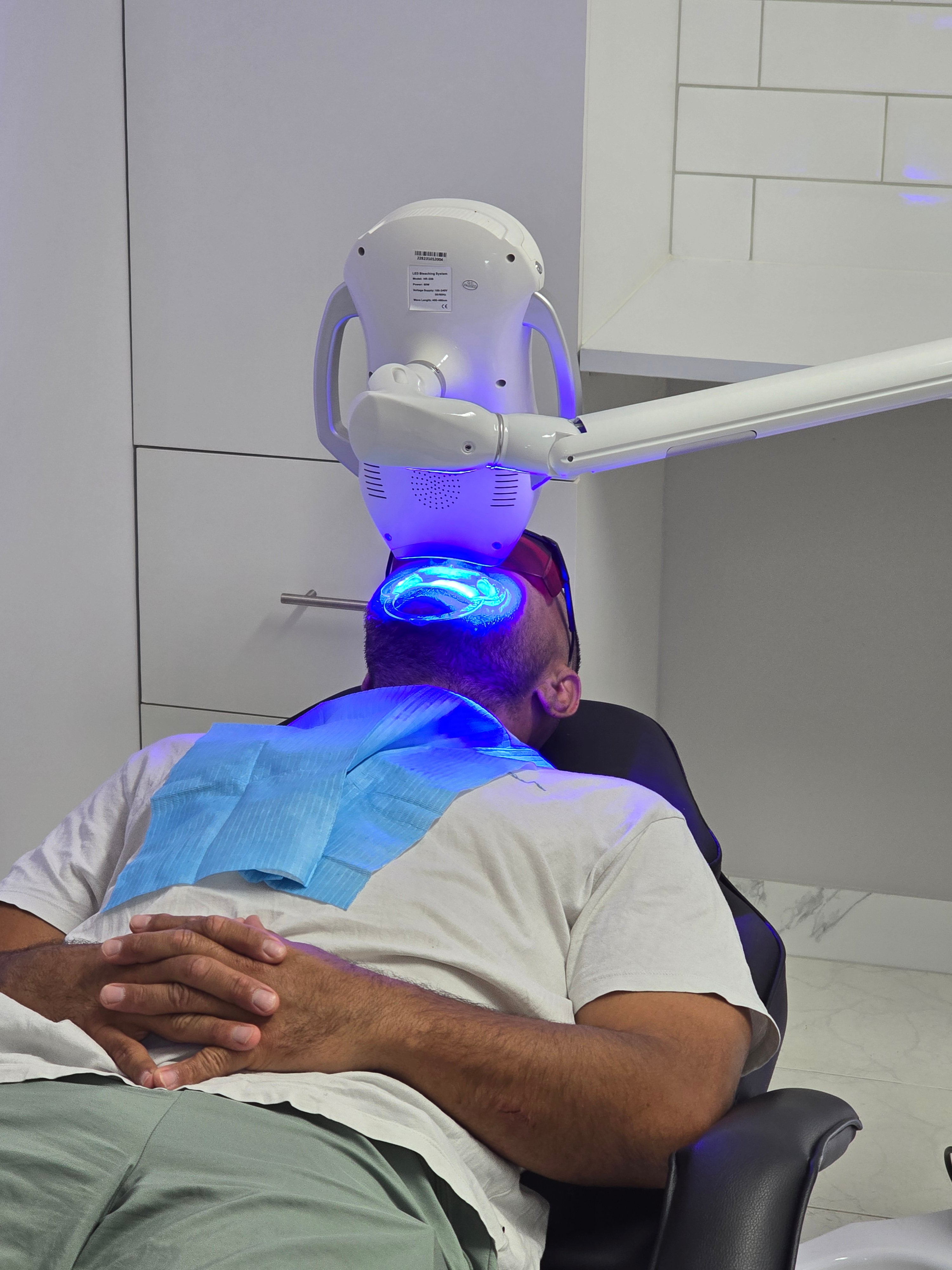 My Transformation, Teeth Witening Perth, Cosmetic Whitening, Instantley A Whiter Smile, Affordable Cosmetic Teeth Whitening,