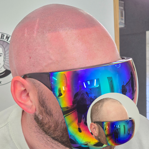 My Transformation, Scalp Micropigmentation Perth, Hair Tattoo Perth, MP Perth, SMP WA, Perth Australia