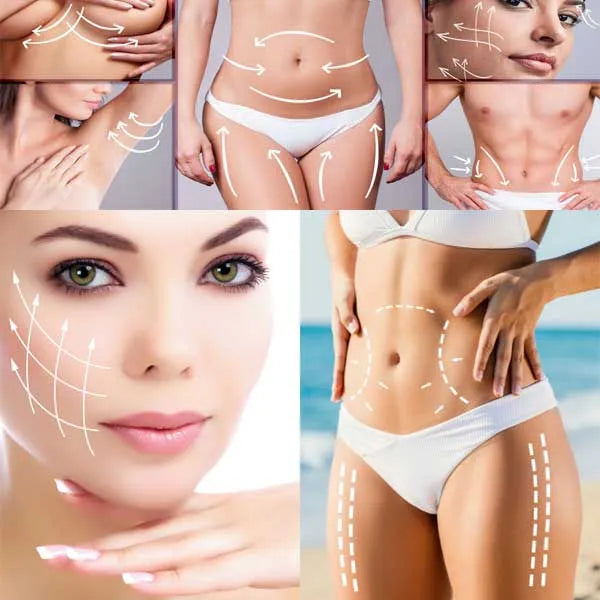 Body Sculpting—Body contouring treatment for cellulite reduction, skin tightening, orange peel reduction, and stretch mark improvement. Perth, WA Australia.