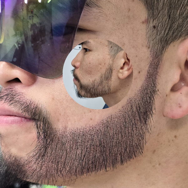 My Transformation, Beard Micropigmentation Perth, Hair Tattoo Perth, SMP Perth, SMP WA, Beard Tattoo