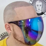 My Transformation, Scalp Micropigmentation Perth, Hair Tattoo Perth, SMP Perth, SMP WA, Perth Australia, Men's hair Tattoo