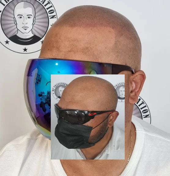 My Transformation, Scalp Micropigmentation Perth, Hair Tattoo Perth, MP Perth, SMP WA, Perth Australia