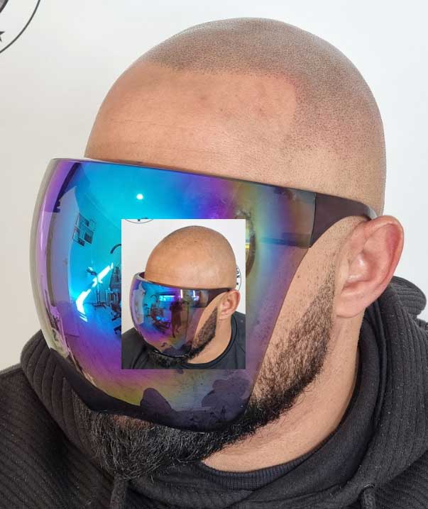 My Transformation, Scalp Micropigmentation Perth, Hair Tattoo Perth, MP Perth, SMP WA, Perth Australia