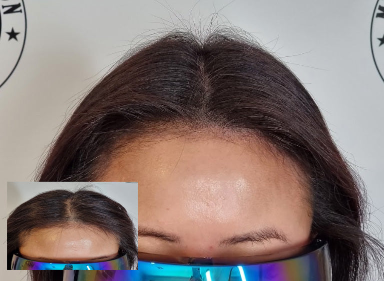 My Transformation, Scalp Micropigmentation Perth, Women's Hair Tattoo Perth, SMP Perth, SMP WA, Perth Australia