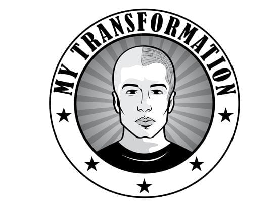 My_Transformation_-_Scalp_Micropigmentation_Perth_Hair_Tattoo_Perth_Beard_Tattoo_Perth_Teeth_Whitening_Perth