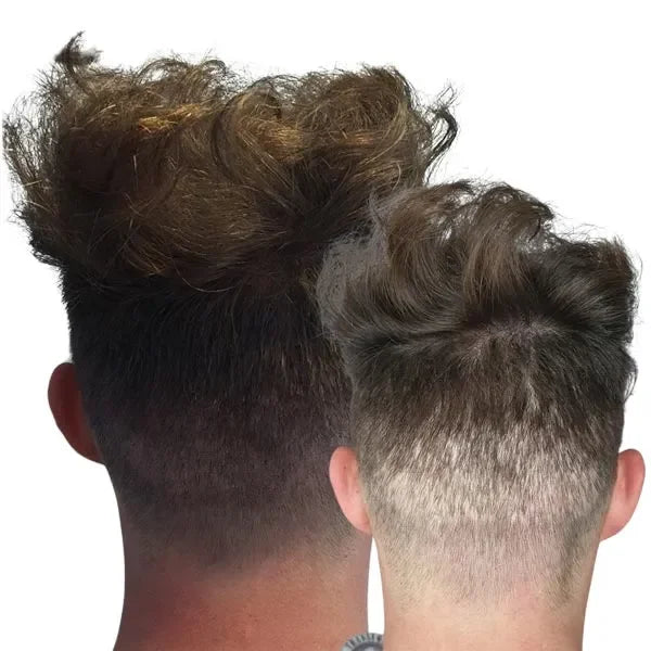 Hair-Tattoo-for-mens-Fue-hair-transplant-covet-up - Hair Tattoo For Scars. If your hair has been thinning and you have gone down the path of having a hair transplant, you may still benefit from Scalp Micropigmentation. Perth, WA Australia.