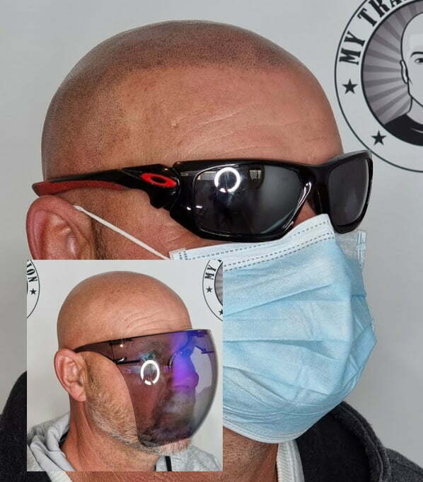 My Transformation, Scalp Micropigmentation Perth, Hair Tattoo Perth, MP Perth, SMP WA, Perth Australia