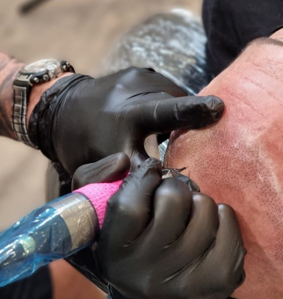 Scalp Micropigmentation in action at my transformation