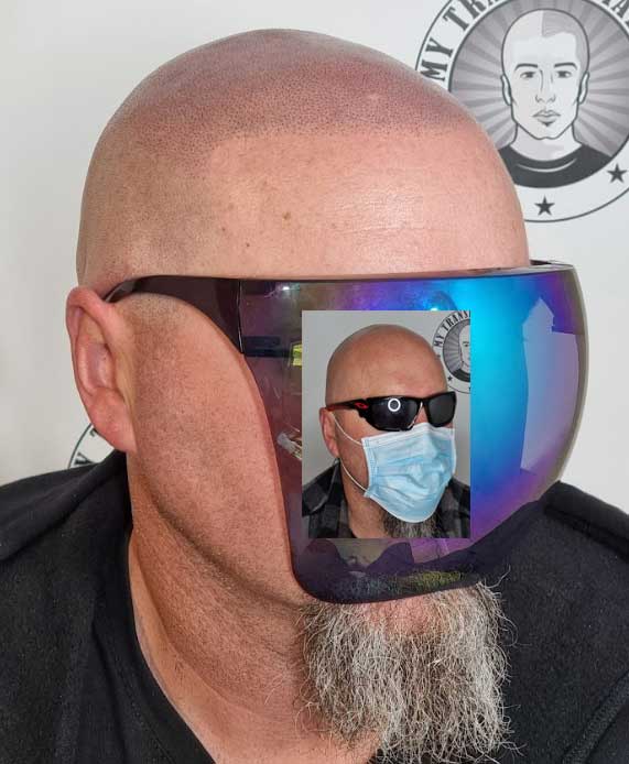 My Transformation, Scalp Micropigmentation Perth, Hair Tattoo Perth, MP Perth, SMP WA, Perth Australia