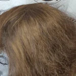 My Transformation, Scalp Micropigmentation Perth, Women's Hair Tattoo Perth, SMP Perth, SMP WA, Perth Australia