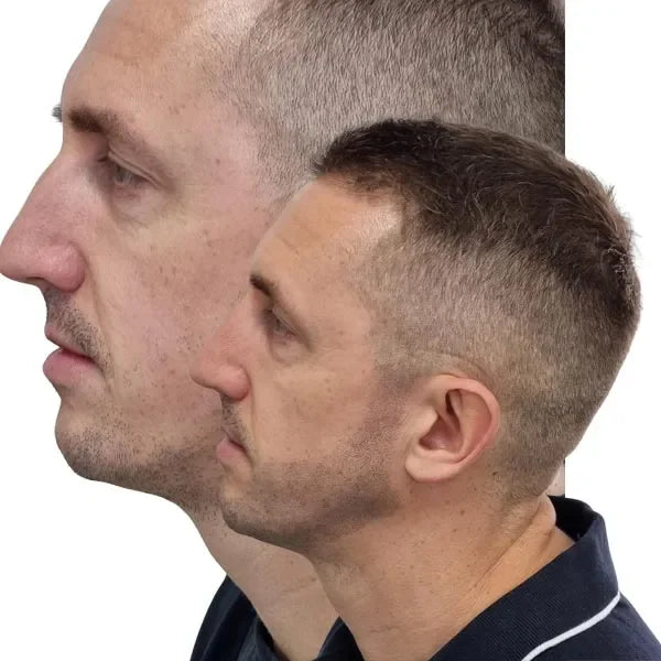 My transformation beard-tattoo-perth