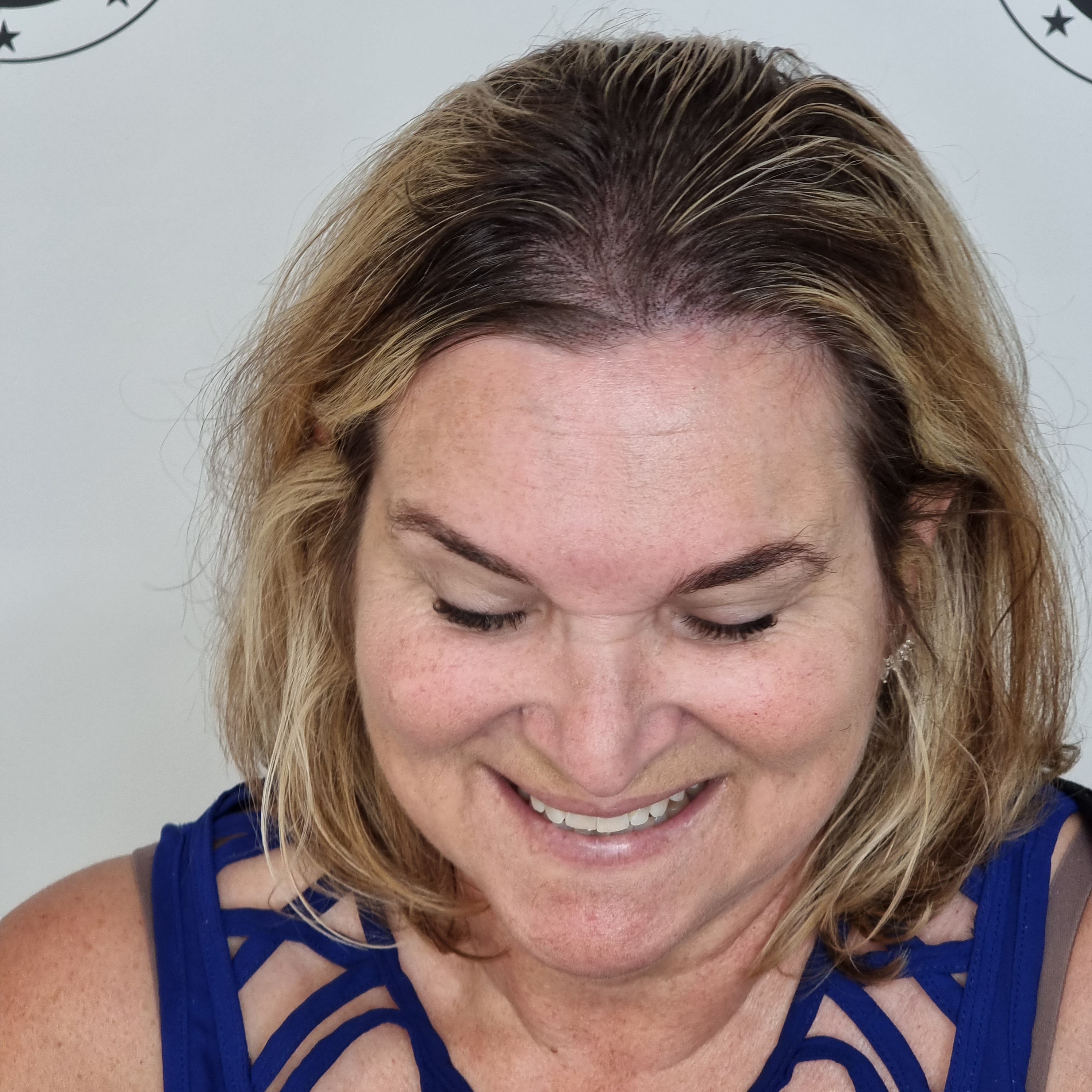 My Transformation, Scalp Micropigmentation Perth, Women's Hair Tattoo Perth, SMP Perth, SMP WA, Perth Australia