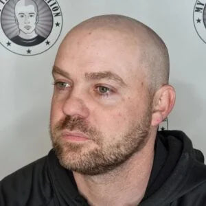 My Transformation, Scalp Micropigmentation Perth, Hair Tattoo Perth, SMP Perth, SMP WA, Perth Australia