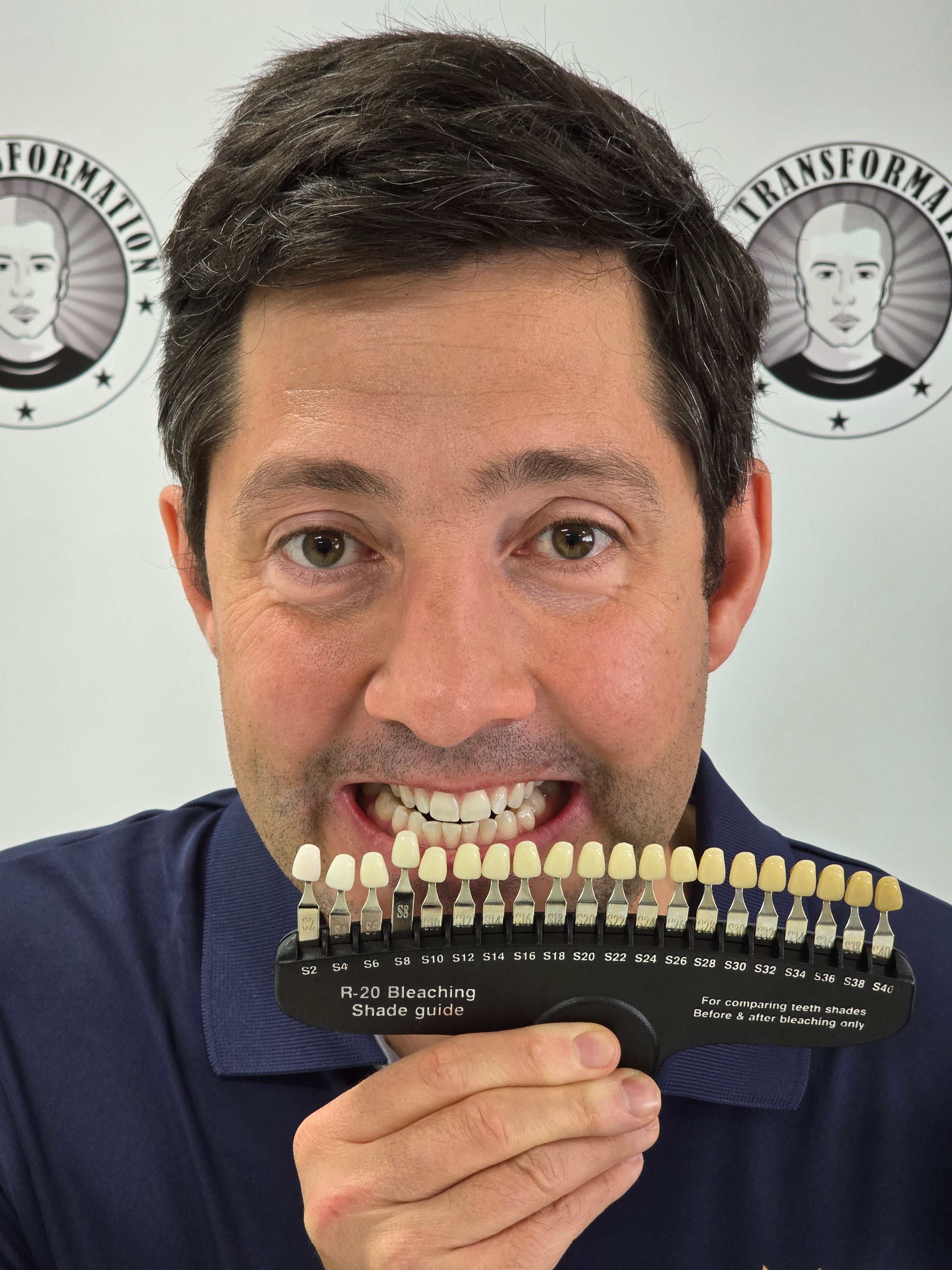 My Transformation, Teeth Witening Perth, Cosmetic Whitening, Instantley A Whiter Smile, Affordable Cosmetic Teeth Whitening,