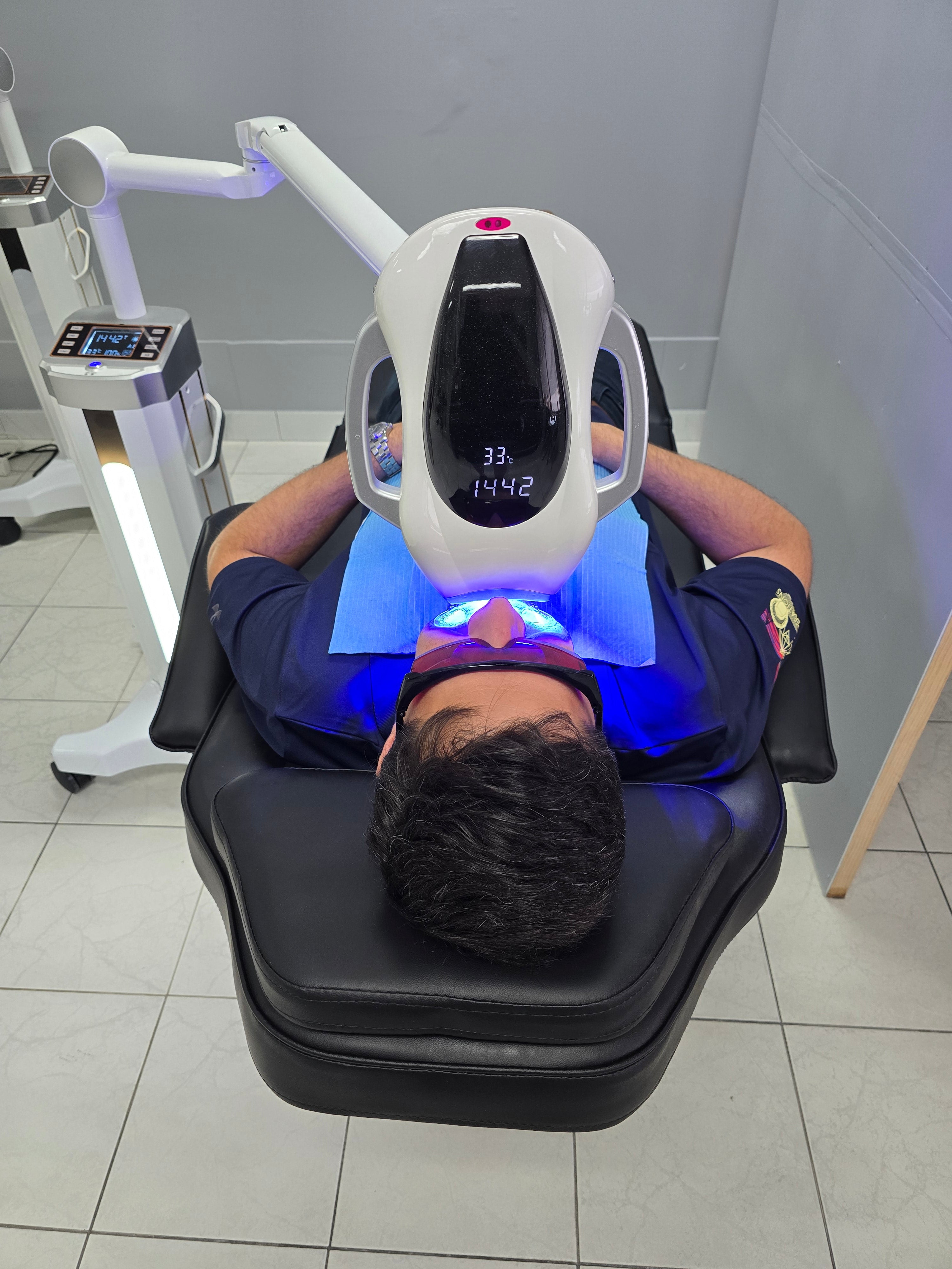 My Transformation, Teeth Witening Perth, Cosmetic Whitening, Instantley A Whiter Smile, Affordable Cosmetic Teeth Whitening,