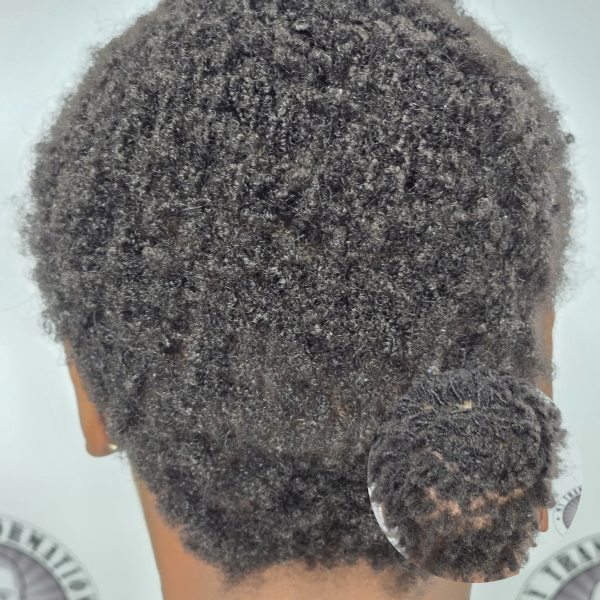 My Transformation,, Women's Hair Tattoo Perth, SMP Perth, SMP WA, Sclp Micropigmentation For Women , Hair Density For Women