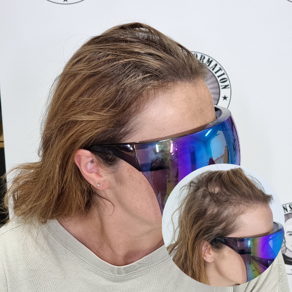 My Transformation, Scalp Micropigmentation Perth, Women's Hair Tattoo Perth, SMP Perth, SMP WA, Perth Australia